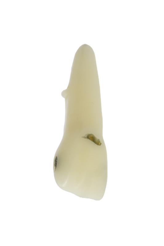 Atsarginis dantis EduDent Restoprep – opakinis, 1 vnt. – 11